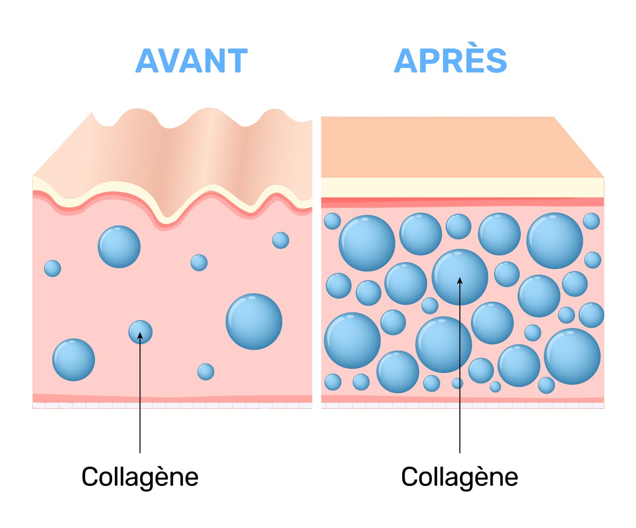 Peau avant et après, avec le collagène dans les tissus