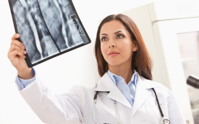 Médecin examinant une radiographie de la colonne vertébrale